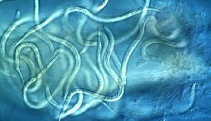 sapertos parasit nematode dina awak manusa