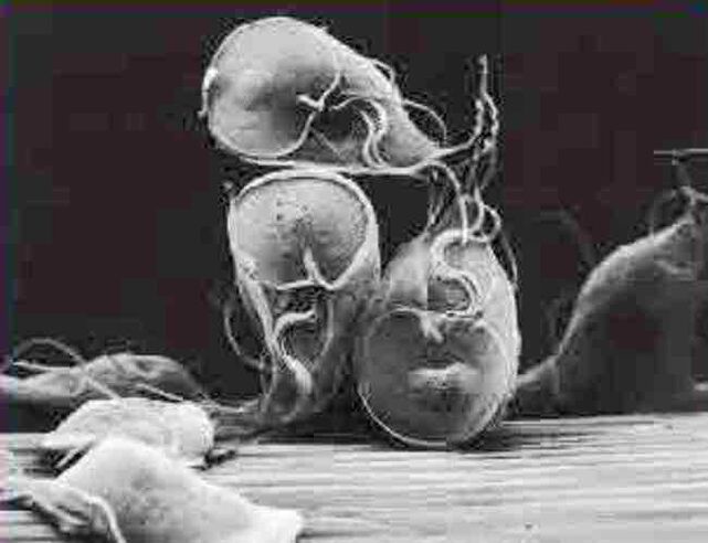 protozoa parasit giardia